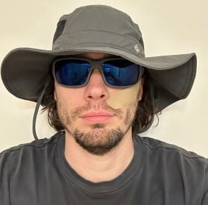 Man wearing filtered sunglasses, a large hat, and a facial bandage.
